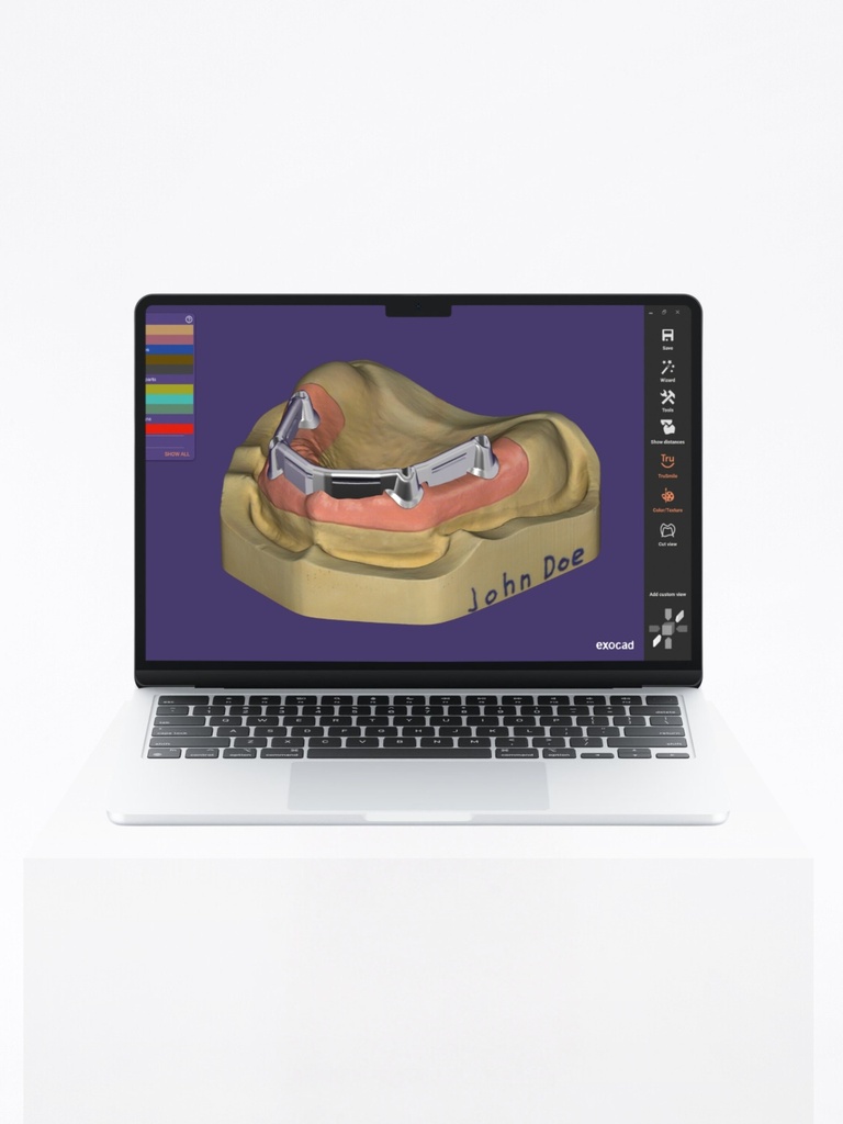 DentalCAD - Modulo Barre