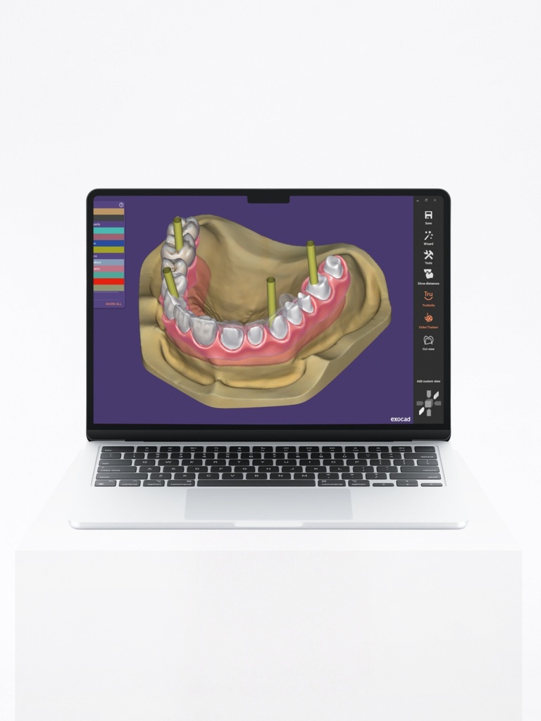 DentalCAD - Implant Lab Bundle