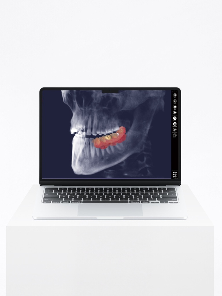 ChairsideCAD - Mill Bundle