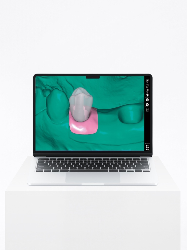 ChairsideCAD - Print Bundle