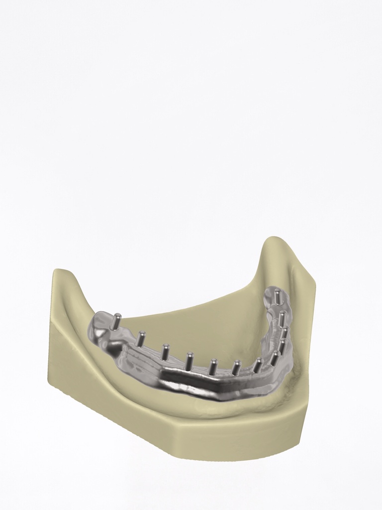 DentalCAD - Modulo Barre