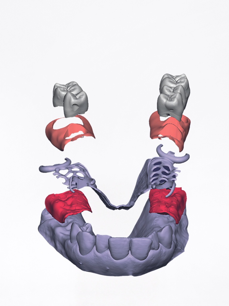 DentalCAD - Modulo PartialCAD