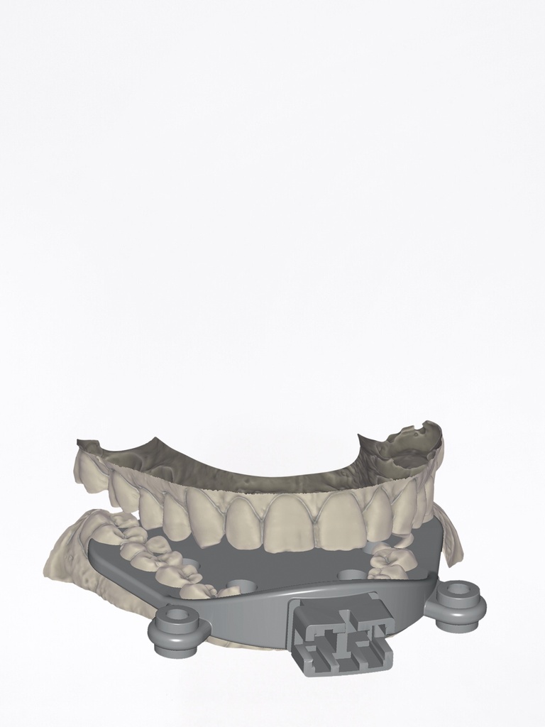 DentalCAD - Modulo Jaw Motion Import Flex