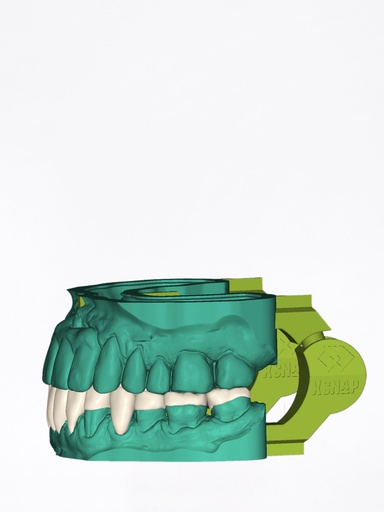 DentalCAD - Modulo xSNAP per Model Creator Stand Alone