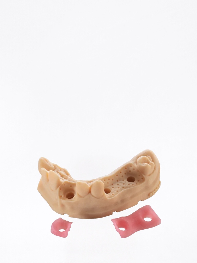 Ultracur3D® DM 2304 Gengiva Mask