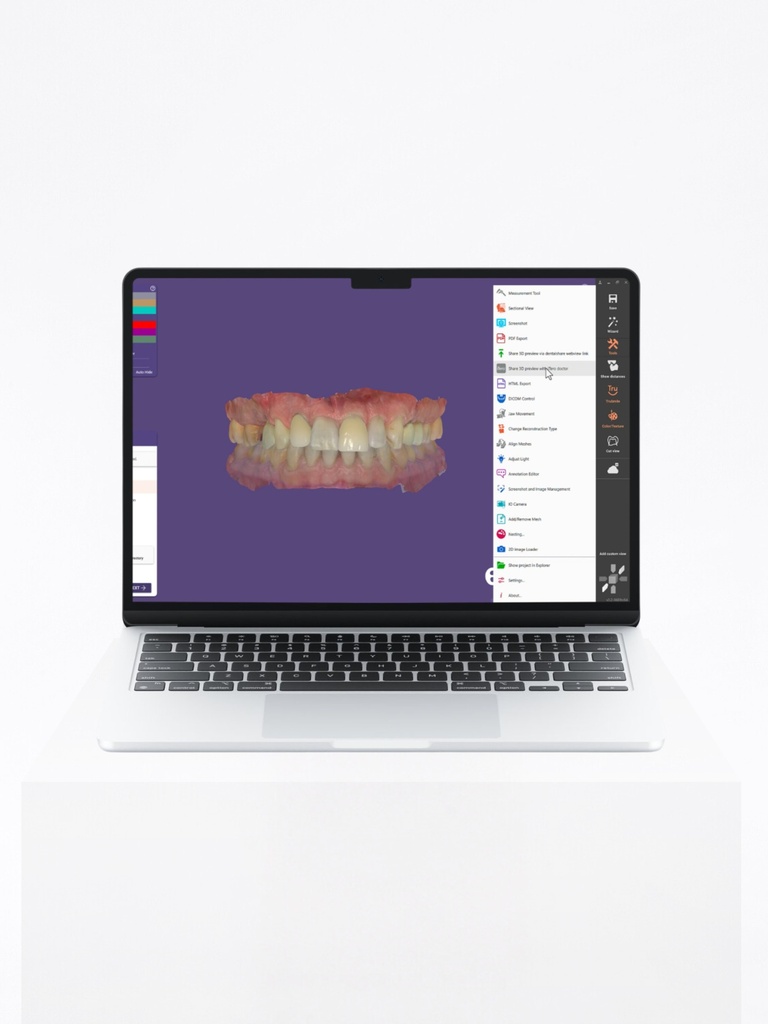 DentalCAD - Core Version Flex