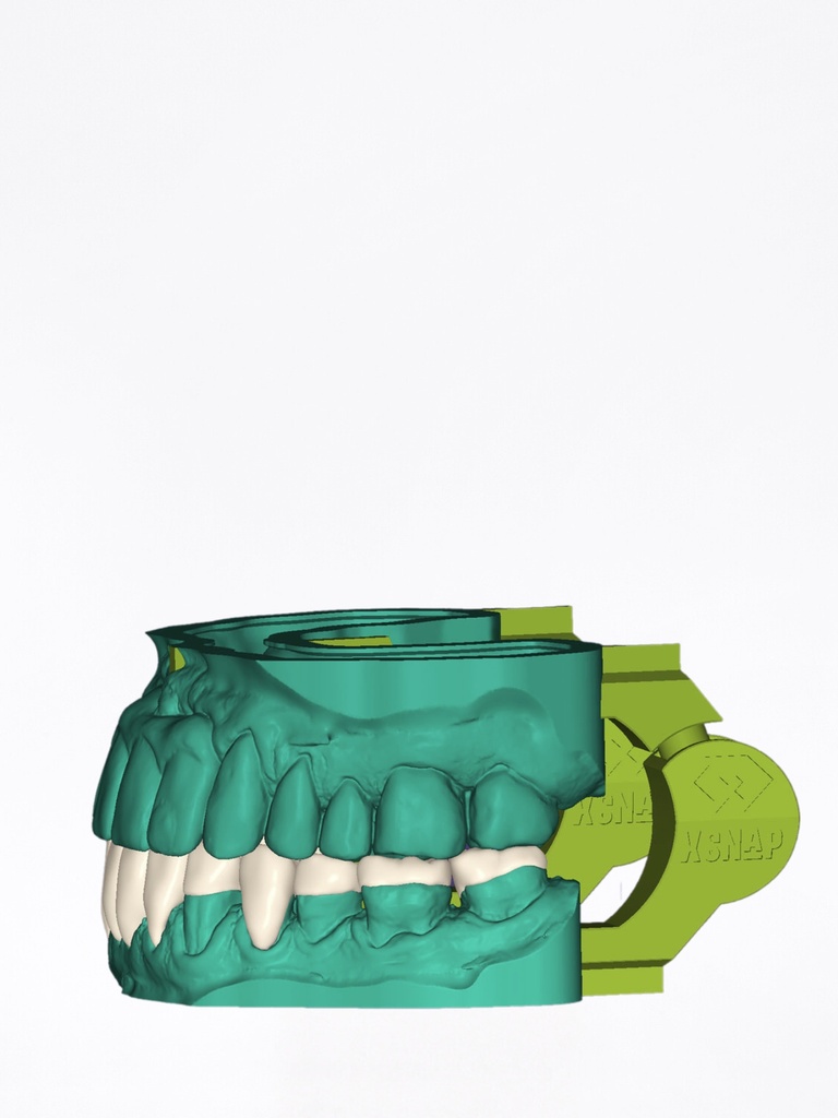 DentalCAD - Modulo xSNAP