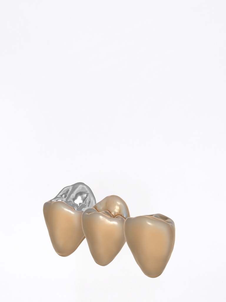 DentalCAD - Modulo TruSmile Flex