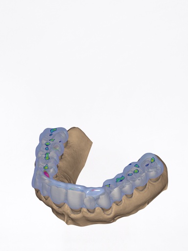 DentalCAD - Modulo Bite Splint Flex