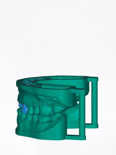 DentalCAD - Modulo Model Creator con Analoghi Implantari Stand Alone